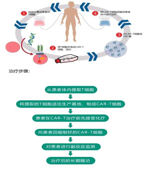 CAR-T细胞治疗过程